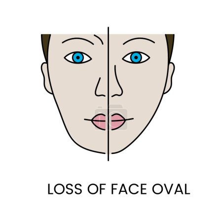 Téléchargez les illustrations : Perte des contours faciaux dans le vecteur, illustration des changements liés à l'âge dans la forme du visage. - en licence libre de droit