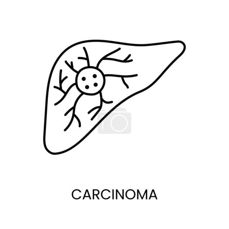 Ilustración de Cáncer carcinoma línea icono vector cáncer enfermedad maligna. - Imagen libre de derechos