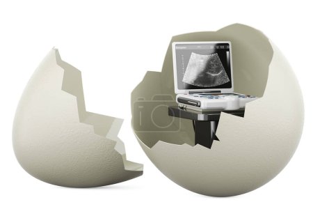 Téléchargez les photos : Œuf avec machine de diagnostic à ultrasons médicaux à l'intérieur, rendu 3D isolé sur fond blanc - en image libre de droit