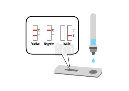 Téléchargez les photos : Interprétation des résultats des tests rapides d'anticorps COVID-19 - en image libre de droit
