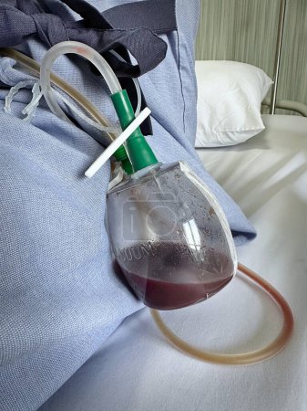 Photo for Vacuum Blood Draining Pot with Tube after Thyroidectomy - Royalty Free Image