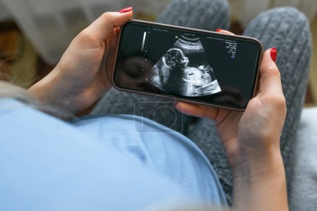 Téléchargez les photos : Femme enceinte vérifiant les scans médicaux en ligne - en image libre de droit