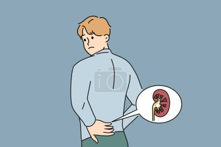 Illustration for Unwell man touch back suffer from kidney pain having stones in body organ. Unhealthy guy struggle with backache from kidney. Vector illustration. - Royalty Free Image