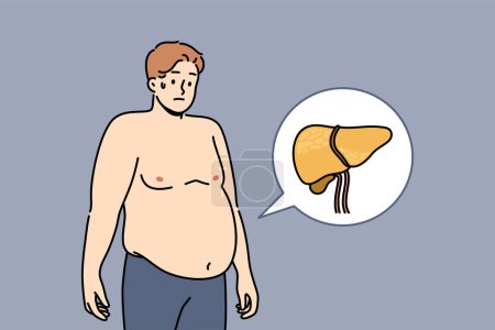 Illustration for Liver illnesses in men cause obesity and digestive problems and symptoms of fatty hepatosis. Yellow liver near guy suffering from jaundice caused by poor hygiene or weakened immune system - Royalty Free Image