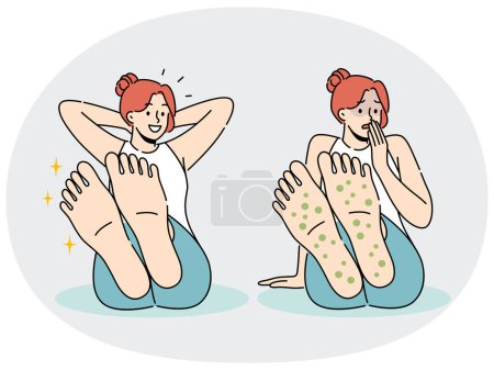 Frau mit Hautausschlag an den Füßen leidet unter Allergien und Pilzinfektionen, die starken Juckreiz und Geruch verursachen. Trauriges und glückliches Mädchen vor und nach dem Auftragen von Heilcreme gegen Pilzbefall an Füßen