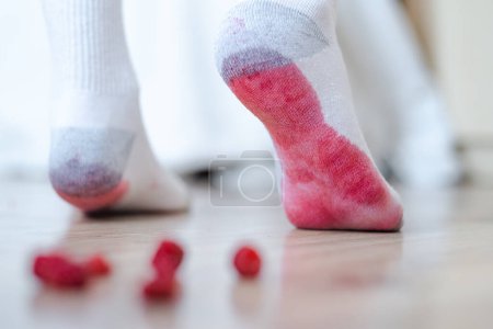 Photo for A dirty socks stains from crushed berries. daily life stain concept. High quality photo - Royalty Free Image