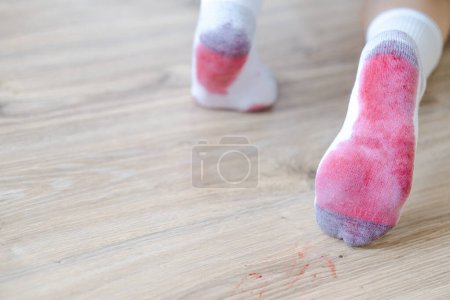 Photo for Dirty stains of spilled juice on white socks. daily life stain concept. space for text. High quality photo - Royalty Free Image