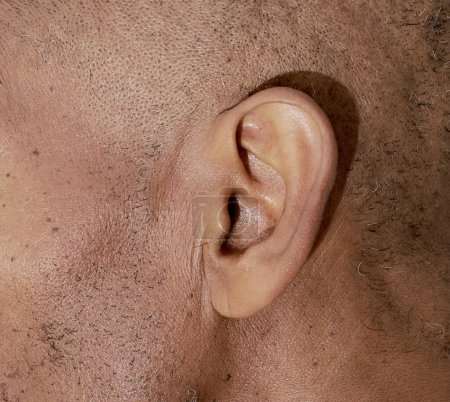 Photo for Man suffering from deafness and hearing loss - Royalty Free Image