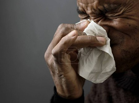 Foto de Hombre soplando la nariz después de contraer la gripe y el resfriado - Imagen libre de derechos