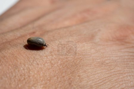 Photo for Deer Tick removed from an accidental host, diseases transmission - Royalty Free Image