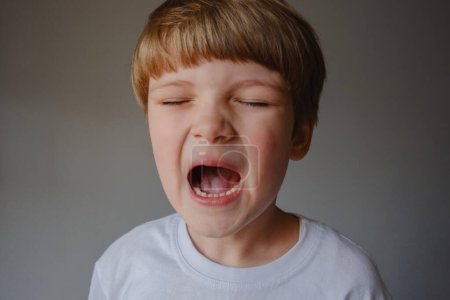 Téléchargez les photos : Closeup portrait of a kid showing his teeth with Cavities problem - en image libre de droit