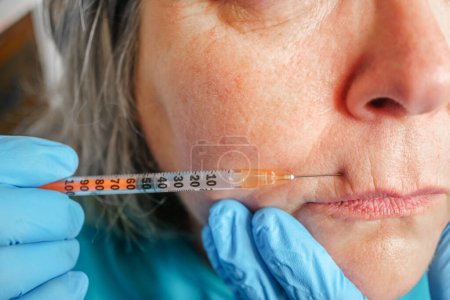Foto de La mujer mayor se inyecta en los labios. clínica de cirugía plástica. - Imagen libre de derechos