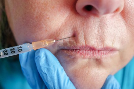 Foto de La mujer mayor se inyecta en los labios. clínica de cirugía plástica. - Imagen libre de derechos