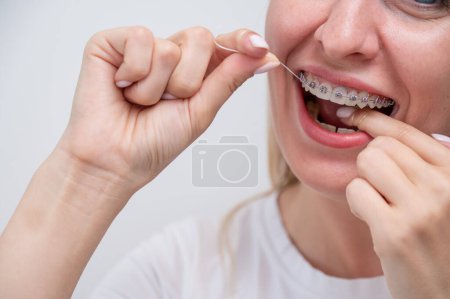 Foto de Mujer caucásica limpiando sus dientes con aparatos ortopédicos usando hilo dental - Imagen libre de derechos