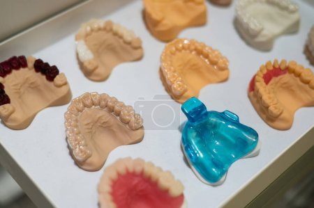 Photo for Plaster casts of the jaws. Variety of samples in the prosthetic workshop - Royalty Free Image