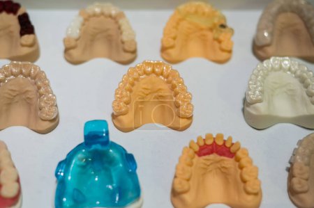 Photo for Plaster casts of the jaws. Variety of samples in the prosthetic workshop - Royalty Free Image