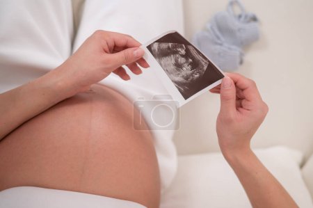 A faceless pregnant woman sits on a white sofa and holds an ultrasound photo of the fetus