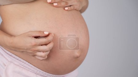 Téléchargez les photos : Une femme se gratte le ventre. Allergies cutanées pendant la grossesse - en image libre de droit