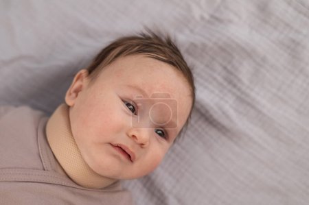 Draufsicht eines Neugeborenen mit orthopädischem Halsband