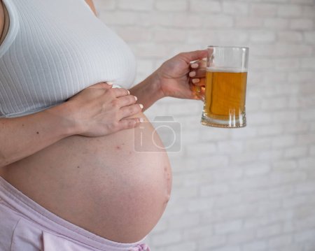 Gesichtslose Schwangere mit Hautausschlag im Bauch hält Glas Bier