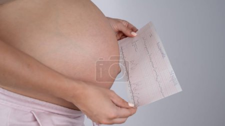 Téléchargez les photos : Femme enceinte avec ventre nu tenant les résultats de cardiotocographie - en image libre de droit