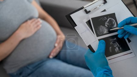 Téléchargez les photos : Gynécologue regarde une échographie d'une femme enceinte - en image libre de droit