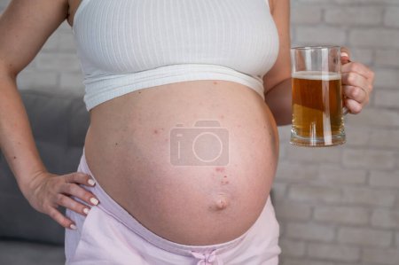 Faceless pregnant woman with rash on stomach holding glass of beer