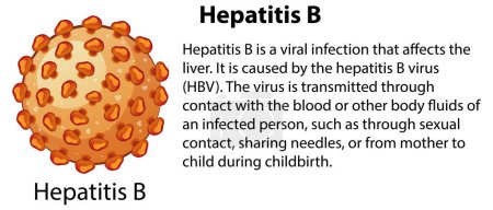 Illustration for Hepatitis B with explanation illustration - Royalty Free Image