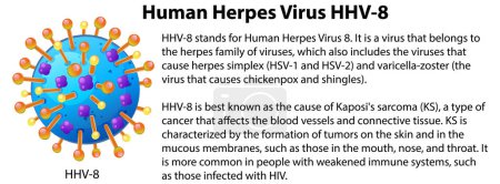 Téléchargez les illustrations : Virus de l'herpès humain HHV 8 avec illustration d'explication - en licence libre de droit