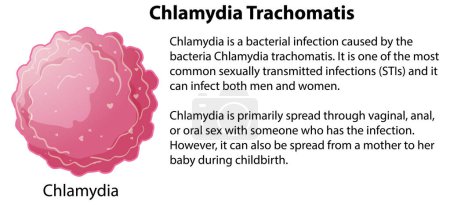 Illustration for Chlamydia Trachomatis with explanation illustration - Royalty Free Image