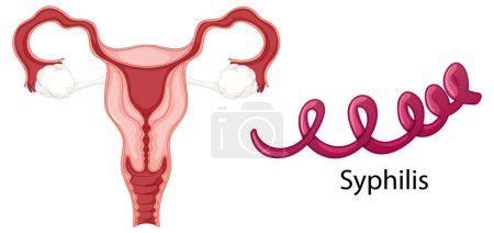 Illustration for Vaginal infection bacteria concept illustration - Royalty Free Image