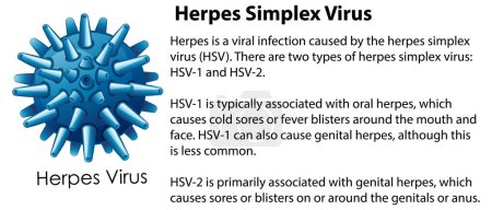 Illustration for Herpes Simplex Virus with explanation illustration - Royalty Free Image