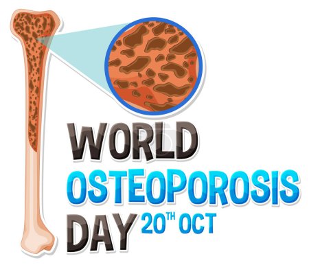 Ilustración de Día Mundial de la Osteoporosis en octubre ilustración - Imagen libre de derechos