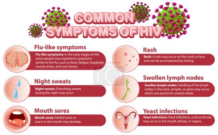 Ilustración de Cartel informativo de los síntomas comunes de la ilustración del VIH - Imagen libre de derechos