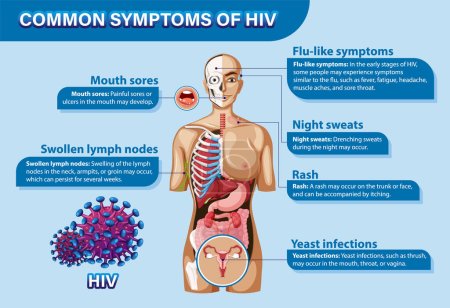 Cartel informativo de los síntomas comunes de la ilustración del VIH