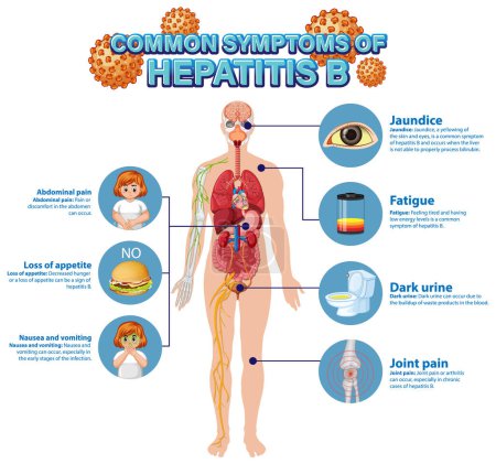 Illustration for Informative poster of common symptoms Hepatitis B illustration - Royalty Free Image