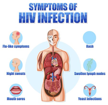 Illustration for Informative poster of main symptoms of HIV illustration - Royalty Free Image