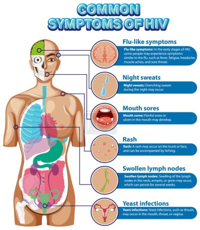 Affiche informative des symptômes courants du VIH illustration