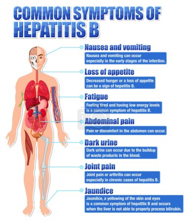 Informative poster of common symptoms Hepatitis B illustration