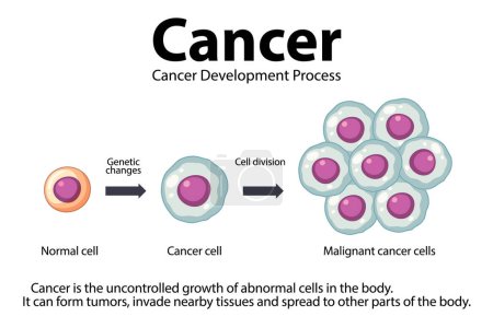 Ilustración de Infografía ilustrada que muestra el desarrollo y procesamiento de las células cancerosas - Imagen libre de derechos
