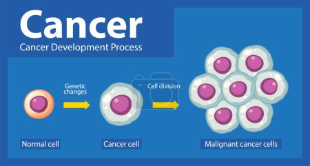Ilustración de Conocer el desarrollo y el procesamiento de las células cancerosas mediante una infografía - Imagen libre de derechos