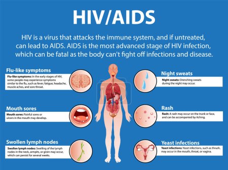 Ilustración de Ilustración que muestra cómo el virus del VIH / SIDA afecta el sistema inmunitario y varias partes del cuerpo - Imagen libre de derechos