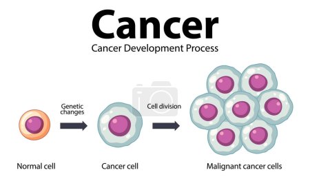 Illustration for Illustrated infographic depicting the development and processing of cancer cells - Royalty Free Image