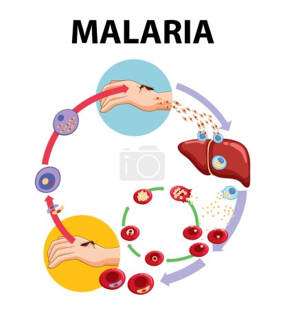 Illustration for Illustrated infographic depicting the stages of malaria parasite transmission - Royalty Free Image