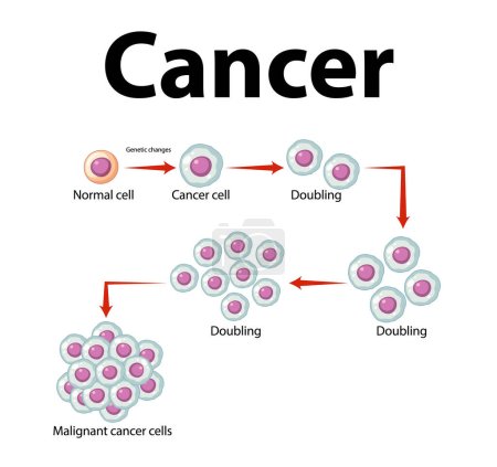Téléchargez les photos : Comprendre le développement et le traitement des cellules cancéreuses grâce à une infographie - en image libre de droit