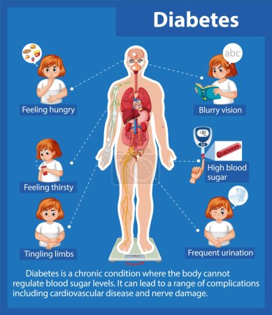 Illustration for An infographic illustrating the effects of diabetes on the human body - Royalty Free Image