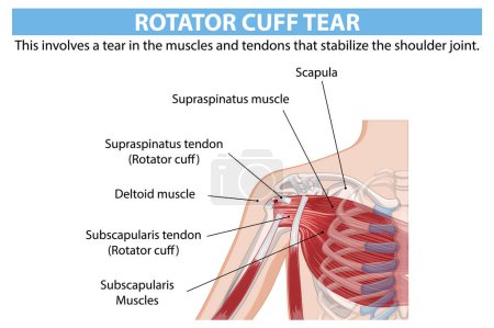 Detailed anatomy of shoulder rotator cuff tear