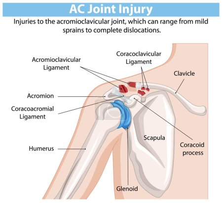 Ilustración de Ilustración detallada de la anatomía de la articulación del hombro - Imagen libre de derechos