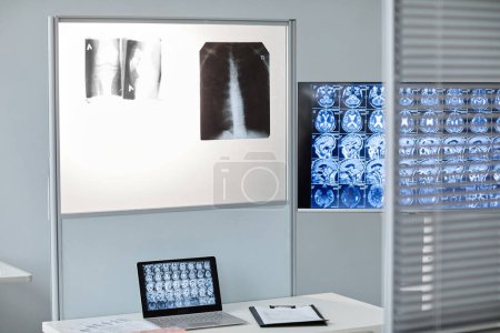 Téléchargez les photos : Horizontal aucune personne prise de radiographie et de tomographie images imprimées et sur l'écran de l'ordinateur dans le bureau moderne à l'hôpital - en image libre de droit