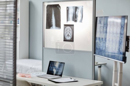 Téléchargez les photos : Pas de personnes prises de vue de radiologistes modernes intérieur de bureau avec ordinateur portable, écran, radiographie et tomographie images - en image libre de droit